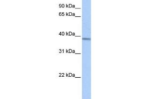 Western Blotting (WB) image for anti-Acyl-CoA Dehydrogenase, Short/branched Chain (ACADSB) antibody (ABIN2459779) (ACADSB Antikörper)