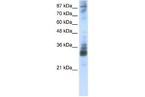 WB Suggested Anti-RG9MTD2 Antibody Titration:  2. (RG9MTD2 Antikörper  (Middle Region))