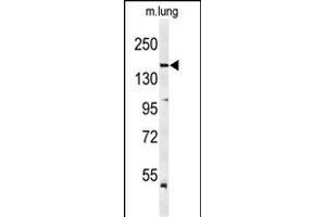 Western blot analysis of KDR  Antibody (ABIN652371 and ABIN2841771) in mouse lung tissue lysates (35 μg/lane). (VEGFR2/CD309 Antikörper  (Tyr1175))