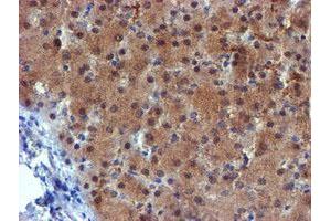 Image no. 8 for anti-Mannose Phosphate Isomerase (MPI) antibody (ABIN1499545) (MPI Antikörper)