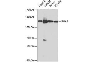 Western blot analysis of extracts of various cell lines, using PHKB antibody (ABIN6129077, ABIN6145560, ABIN6145561 and ABIN6224038) at 1:1000 dilution. (PHKB Antikörper  (AA 854-1093))