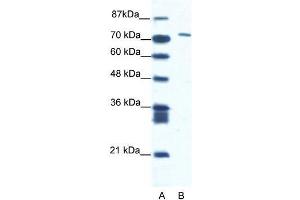 Human Jurkat; WB Suggested Anti-CXORF6 Antibody Titration: 1. (MAMLD1 Antikörper  (N-Term))