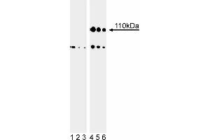 Western blot analysis of Rb (pS807/pS811) in human embryonic skin cells.