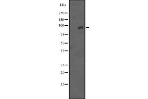 Western blot analysis of ITGB7 expression in A431 whole cell lysate ,The lane on the left is treated with the antigen-specific peptide. (Integrin beta 7 Antikörper  (Internal Region))