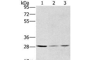 Western Blot analysis of A375, hela and A172 cell using HSD17B12 Polyclonal Antibody at dilution of 1:570 (HSD17B12 Antikörper)