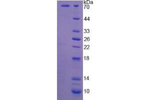 SDS-PAGE analysis of Human CAPN5 Protein. (Calpain 5 Protein (CAPN5))