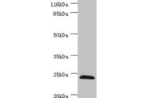 Western blot All lanes: GSTZ1 antibody at 0. (GSTZ1 Antikörper  (AA 1-216))