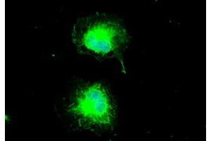 Anti-CTAG1B mouse monoclonal antibody (ABIN2452329) immunofluorescent staining of COS7 cells transiently transfected by pCMV6-ENTRY CTAG1B (RC213318). (CTAG1B Antikörper)