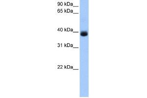 Western Blotting (WB) image for anti-serpin Peptidase Inhibitor, Clade A (Alpha-1 Antiproteinase, Antitrypsin), Member 5 (SERPINA5) (C-Term) antibody (ABIN2785440)