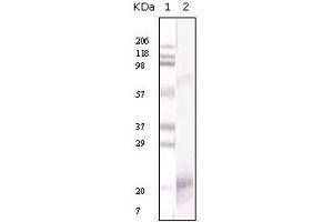 Western Blotting (WB) image for anti-Interferon gamma (IFNG) antibody (ABIN2464066) (Interferon gamma Antikörper)