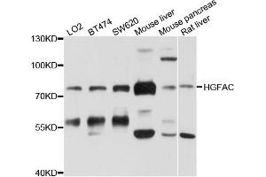 Western blot analysis of extracts of various cell lines, using HGFAC antibody (ABIN6003812) at 1/1000 dilution. (HGFA Antikörper)