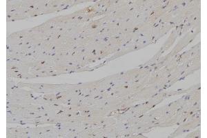 ABIN6258115 and ABIN6274297 at 1/100 staining Mouse heart tissue by IHC-P. (DLX5 Antikörper  (Internal Region))