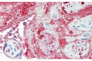 Detection of TPOR in Human Placenta Tissue using Polyclonal Antibody to Thrombopoietin Receptor (TPOR) (MPL Antikörper  (AA 66-260))