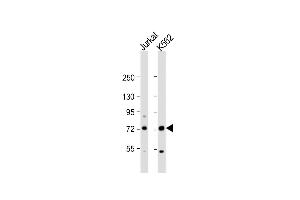 All lanes : Anti-PRMT5 Antibody (N-term) at 1:1000 dilution Lane 1: Jurkat whole cell lysate Lane 2: K562 whole cell lysate Lysates/proteins at 20 μg per lane. (PRMT5 Antikörper  (N-Term))
