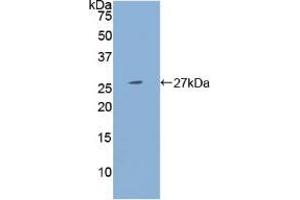 Western blot analysis of recombinant Human PSG1. (PSG1 Antikörper  (AA 202-401))
