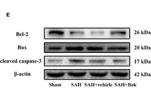 The effects of Bak on cellular apoptosis and neuronal degeneration following SAH. (beta Actin Antikörper  (AA 1-375))