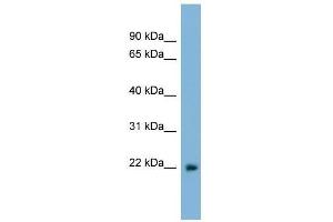 LBX2 antibody used at 0.