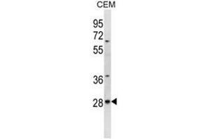 ALKBH4 Antibody (Center) western blot analysis in CEM cell line lysates (35µg/lane). (ALKBH4 Antikörper  (Middle Region))