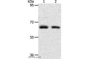 Western blot analysis of Human fetal kidney and fetal lung tissue, using ACOT11 Polyclonal Antibody at dilution of 1:450 (ACOT11 Antikörper)