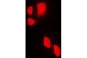 Immunofluorescent analysis of JAK2 staining in Jurkat cells. (JAK2 Antikörper)