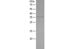 Western Blotting (WB) image for Mannose Receptor, C Type 1 (MRC1) (AA 19-148) protein (His-IF2DI Tag) (ABIN7123842) (Macrophage Mannose Receptor 1 Protein (AA 19-148) (His-IF2DI Tag))