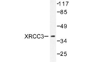Image no. 2 for anti-X-Ray Repair Complementing Defective Repair in Chinese Hamster Cells 3 (XRCC3) antibody (ABIN271981)