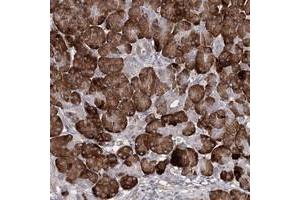 Immunohistochemical staining of human pancreas with TMEM218 polyclonal antibody  shows strong cytoplasmic positivity in exocrine glandular cells. (TMEM218 Antikörper)