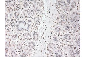 Immunohistochemical staining of paraffin-embedded breast tissue using anti-USP13 mouse monoclonal antibody. (USP13 Antikörper)