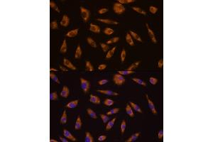 Immunofluorescence analysis of L929 cells using GLP1R antibody (ABIN6131006, ABIN6141138, ABIN6141140 and ABIN6224643) at dilution of 1:100. (GLP1R Antikörper  (AA 22-116))