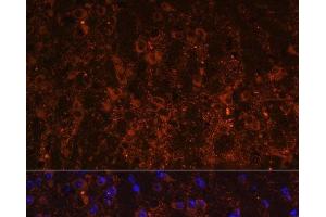 Immunofluorescence analysis of Mouse brain using SNX13 Polyclonal Antibody at dilution of 1:100. (SNX13 Antikörper)