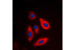 Immunofluorescent analysis of Galactose Kinase staining in HepG2 cells. (GALK1 Antikörper  (N-Term))