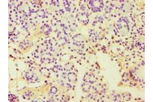 Immunohistochemistry of paraffin-embedded human pancreatic tissue using ABIN7150999 at dilution of 1:100