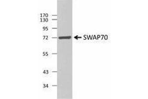 Western Blotting (WB) image for anti-SWAP Switching B-Cell Complex 70kDa Subunit (SWAP70) antibody (ABIN2666297) (SWAP70 Antikörper)