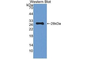 Western Blotting (WB) image for anti-Proopiomelanocortin (POMC) (AA 27-235) antibody (ABIN1077682) (POMC Antikörper  (AA 27-235))