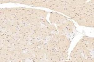 Immunohistochemistry analysis of paraffin-embedded mouse heart using,MCC-2 (ABIN7076163) at dilution of 1: 6000 (USHBP1 Antikörper)