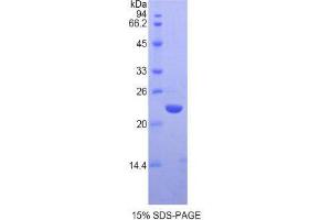 SDS-PAGE (SDS) image for Chromobox Homolog 3 (CBX3) (AA 1-183) protein (His tag) (ABIN1821701)