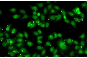 Immunofluorescence analysis of MCF7 cells using NR2C1 Polyclonal Antibody (NR2C1 Antikörper)