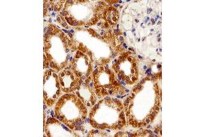 Immunohistochemical analysis of paraffin-embedded H. (FBXL17 Antikörper  (C-Term, Isoform 2))