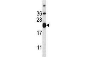 Western Blotting (WB) image for anti-CD3 epsilon (CD3E) (AA 154-182) antibody (ABIN3030389)