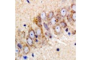 Immunohistochemical analysis of IGF2BP3 staining in mouse brain formalin fixed paraffin embedded tissue section.