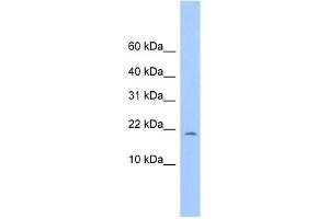 C10ORF83 antibody used at 1 ug/ml to detect target protein. (MORN4 Antikörper  (Middle Region))