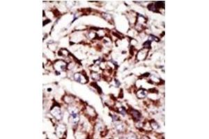 Image no. 1 for anti-Palmitoyl-Protein Thioesterase 1 (PPT1) (C-Term) antibody (ABIN357784) (PPT1 Antikörper  (C-Term))