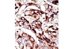 Image no. 1 for anti-Palmitoyl-Protein Thioesterase 1 (PPT1) (C-Term) antibody (ABIN357784)