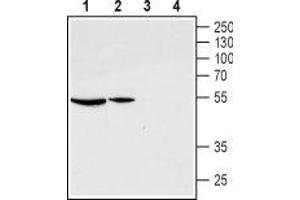 Western blot analysis of rat ovary (lanes 1 and 3) and pituitary (lanes 2 and 4) lysates: - 1,2. (GNRHR Antikörper  (Extracellular, N-Term))