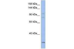 WB Suggested Anti-KCNQ5 Antibody Titration:  0. (KCNQ5 Antikörper  (Middle Region))