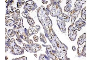 IHC analysis of VEGF Receptor 3 using anti-VEGF Receptor 3 antibody . (FLT4 Antikörper)