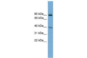 WB Suggested Anti-L3mbtl Antibody Titration: 0. (L3MBTL1 Antikörper  (Middle Region))