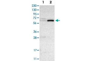 Western Blot analysis of Lane 1: RT-4 and Lane 2: U-251 MG sp cell lysates with CRAT polyclonal antibody . (CRAT Antikörper)