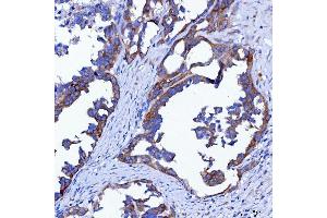 IHC analysis of SWAP70 using anti-SWAP70 antibody (ABIN7600201). (SWAP70 Antikörper  (AA 161-292))