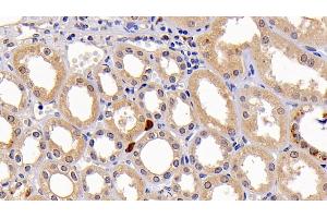 Immunohistochemistry (IHC) image for anti-Caspase 3 (CASP3) (AA 29-175) antibody (ABIN7428803)